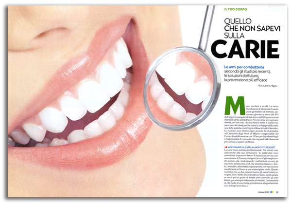articolo carie, dentista Torino, Catino